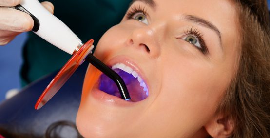 Happens During the Procedure for Dental Fillings