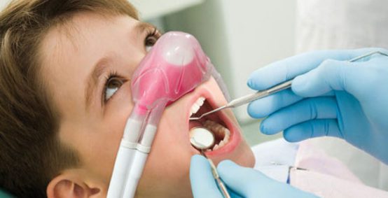 Nitrous Oxide Sedation Dentistry
